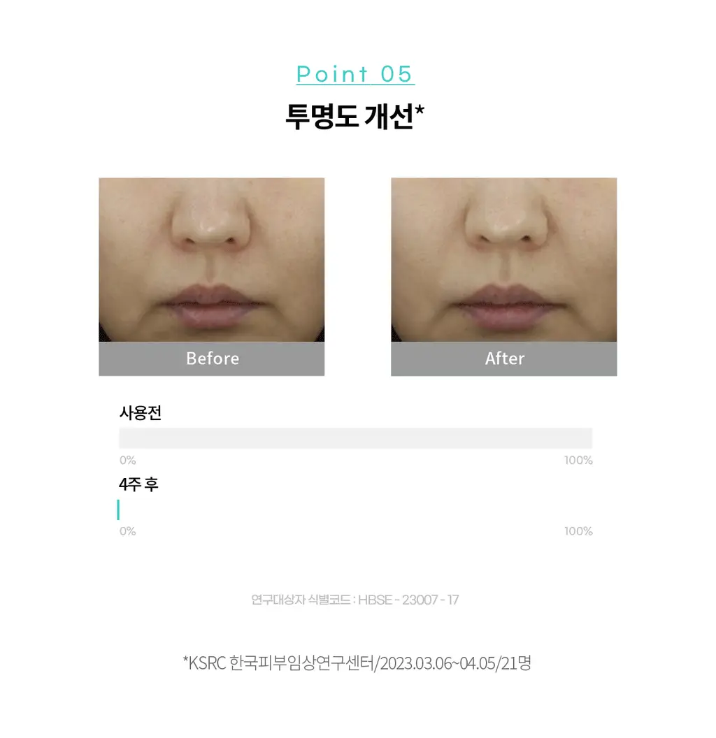 [PDRN기미크림/광노화케어 신소재] 리쥬란 바이옴 힐러 유스 포뮬러 크림 50ml 상세페이지 18